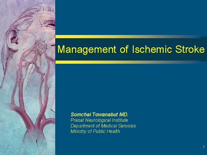 Management of Ischemic Stroke Somchai Towanabut MD. Prasat Neurological Institute Department of Medical Services