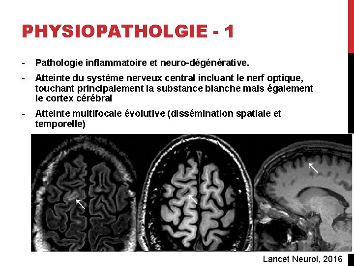 PHYSIOPATHOLGIE - 1 - Pathologie inflammatoire et neuro-dégénérative. - Atteinte du système nerveux central