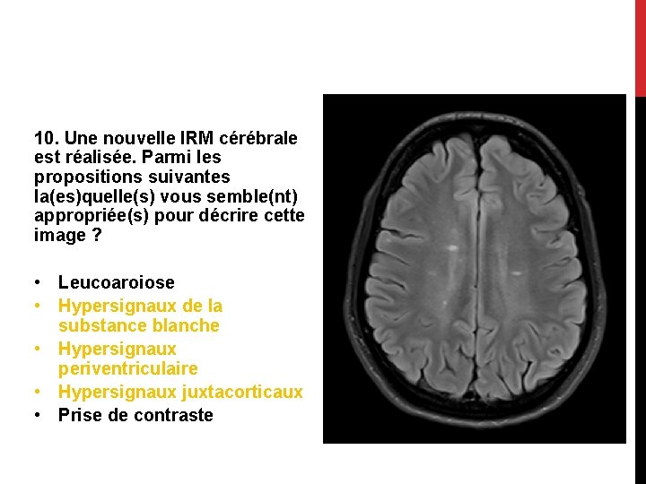 10. Une nouvelle IRM cérébrale est réalisée. Parmi les propositions suivantes la(es)quelle(s) vous semble(nt)