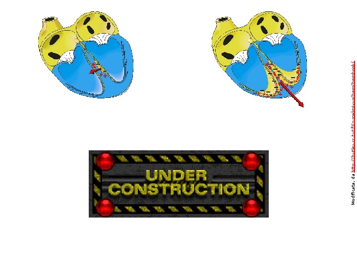 Modificata, da http: //butler. cc. tut. fi/~malmivuo/bembook/ 