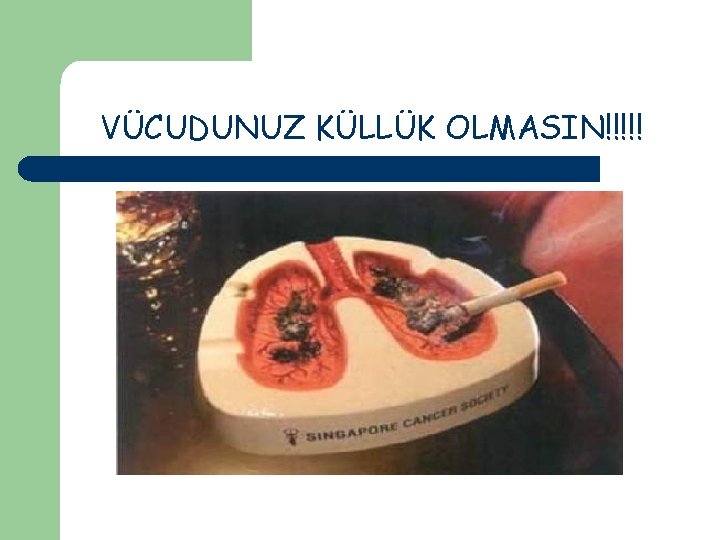 VÜCUDUNUZ KÜLLÜK OLMASIN!!!!! 