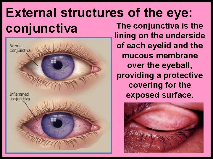 External structures of the eye: The conjunctiva is the conjunctiva lining on the underside