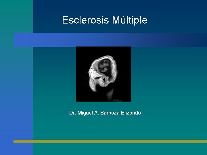 Esclerosis Múltiple Dr. Miguel A. Barboza Elizondo 