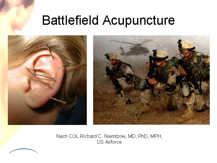 Battlefield Acupuncture Nach COL Richard C. Niemtzow, MD, Ph. D, MPH, US Airforce 