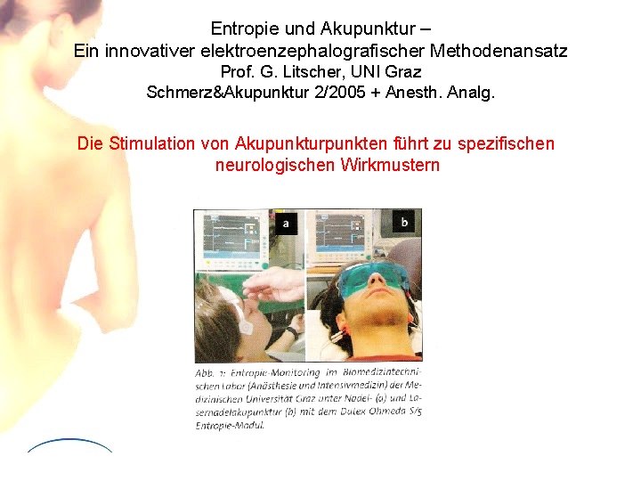 Entropie und Akupunktur – Ein innovativer elektroenzephalografischer Methodenansatz Prof. G. Litscher, UNI Graz Schmerz&Akupunktur Entropie und Akupunktur – Ein innovativer elektroenzephalografischer Methodenansatz Prof. G. Litscher, UNI Graz Schmerz&Akupunktur