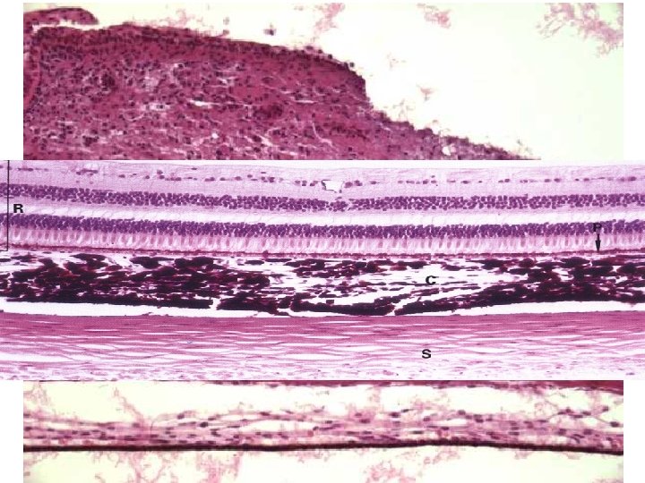 Tunica vasculosa (media) Cévnatka = Choroidea • lamina suprachoroidea (= lamina fusca sclerae) •