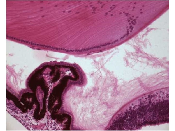 Tunica vasculosa (media) Řasnaté těleso = Corpus ciliare • stroma – m. ciliaris: parasympatikus