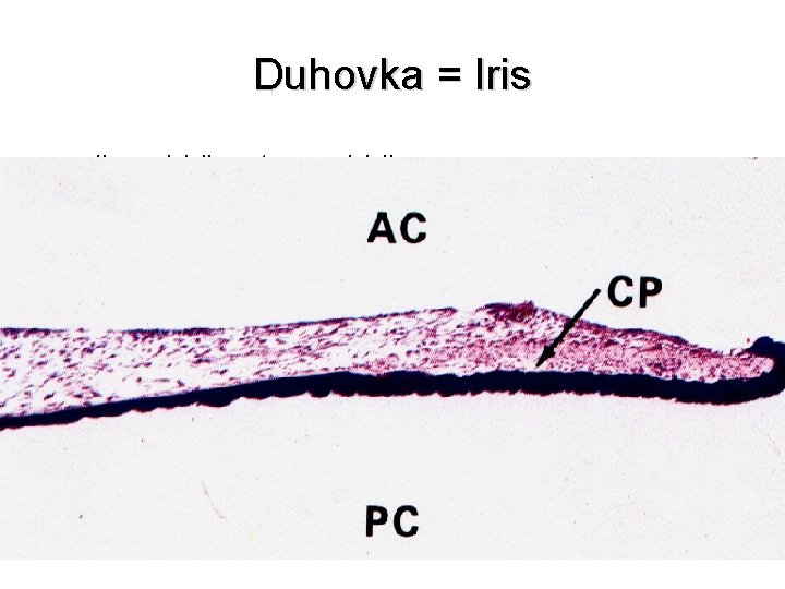 Duhovka = Iris • plicae iridis, stroma iridis • přední plocha – nemá epitelový