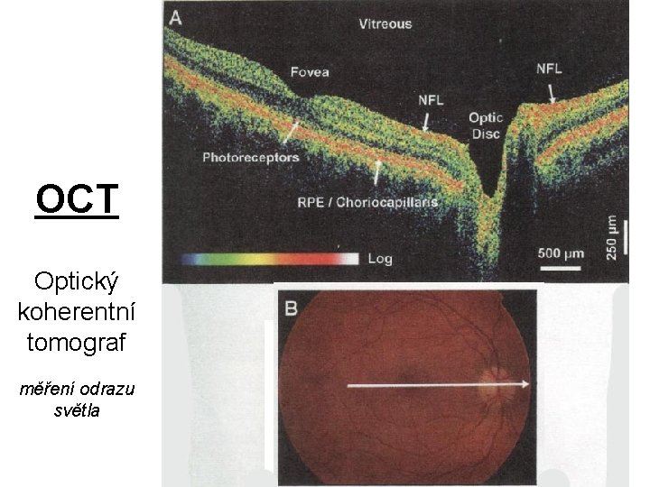 OCT Optický koherentní tomograf měření odrazu světla 
