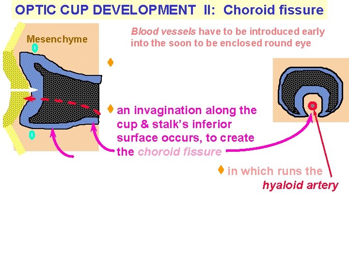OPTIC CUP DEVELOPMENT II: Choroid fissure Mesenchyme Blood vessels have to be introduced early