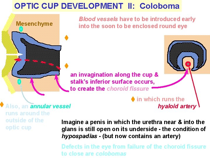 OPTIC CUP DEVELOPMENT II: Coloboma Mesenchyme Blood vessels have to be introduced early into