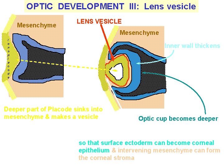 OPTIC DEVELOPMENT III: Lens vesicle Mesenchyme LENS VESICLE Mesenchyme l e n s p