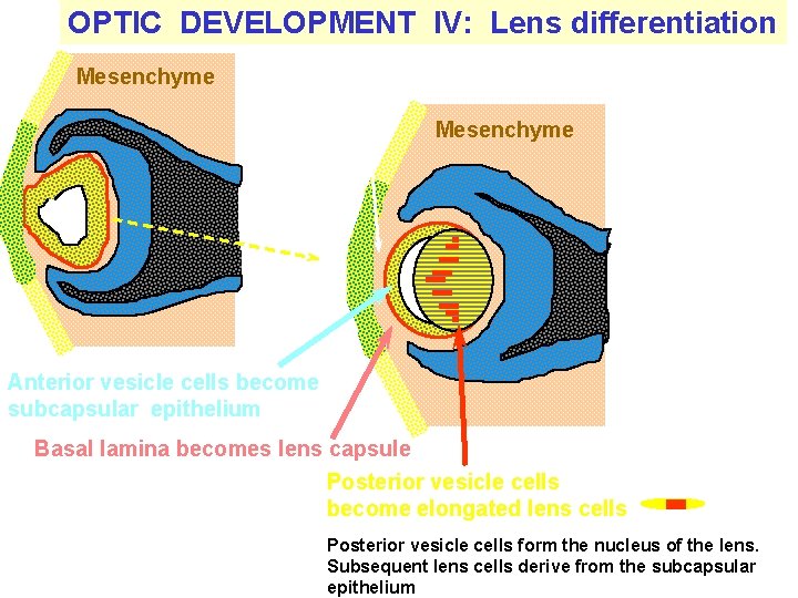 OPTIC DEVELOPMENT IV: Lens differentiation Mesenchyme Attachment to surface ectoderm lost Mesenchyme Anterior vesicle