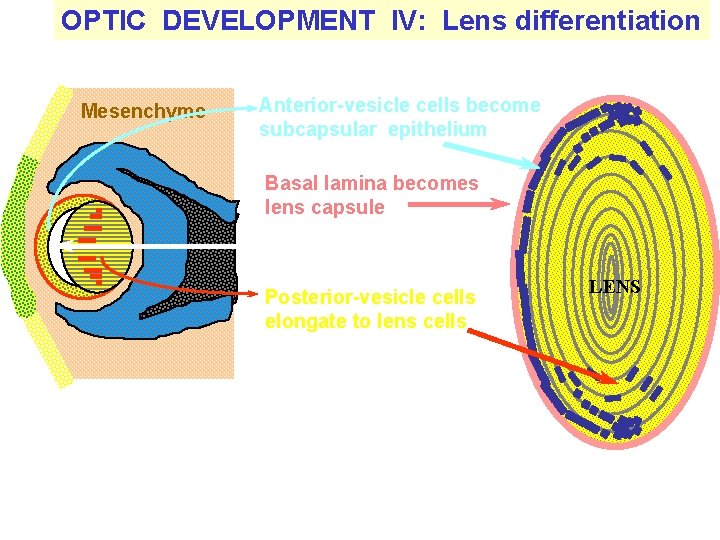 OPTIC DEVELOPMENT IV: Lens differentiation Mesenchyme Anterior-vesicle cells become subcapsular epithelium Basal lamina becomes