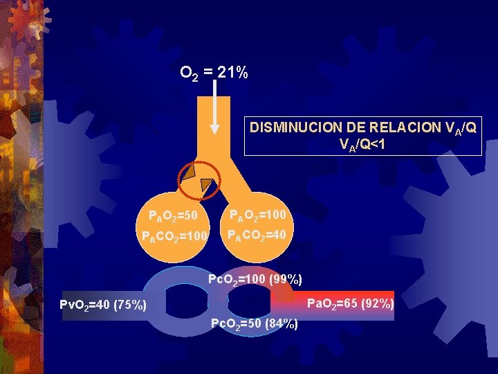 O 2 = 21% DISMINUCION DE RELACION VA/Q<1 PAO 2=50 PAO 2=100 PACO 2=40 O 2 = 21% DISMINUCION DE RELACION VA/Q<1 PAO 2=50 PAO 2=100 PACO 2=40