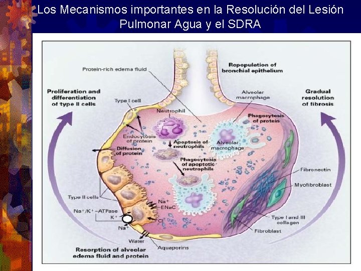 Los Mecanismos importantes en la Resolución del Lesión Pulmonar Agua y el SDRA Los Mecanismos importantes en la Resolución del Lesión Pulmonar Agua y el SDRA