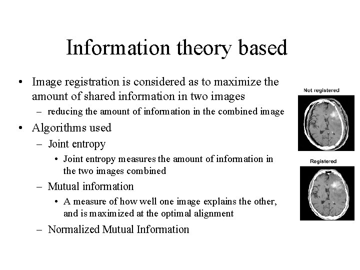 Information theory based • Image registration is considered as to maximize the amount of Information theory based • Image registration is considered as to maximize the amount of