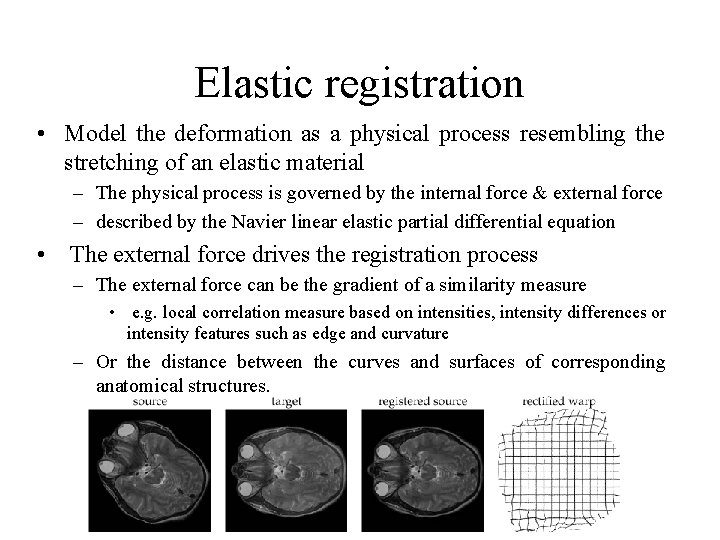 Elastic registration • Model the deformation as a physical process resembling the stretching of Elastic registration • Model the deformation as a physical process resembling the stretching of