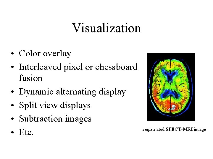 Visualization • Color overlay • Interleaved pixel or chessboard fusion • Dynamic alternating display Visualization • Color overlay • Interleaved pixel or chessboard fusion • Dynamic alternating display