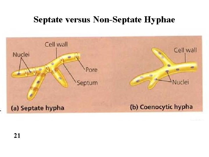 Septate versus Non-Septate Hyphae 21 
