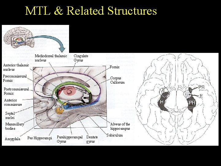 MTL & Related Structures Mediodorsal thalamic nucleus Cingulate Gyrus Anterior thalamic nucleus Fornix Precommissural MTL & Related Structures Mediodorsal thalamic nucleus Cingulate Gyrus Anterior thalamic nucleus Fornix Precommissural