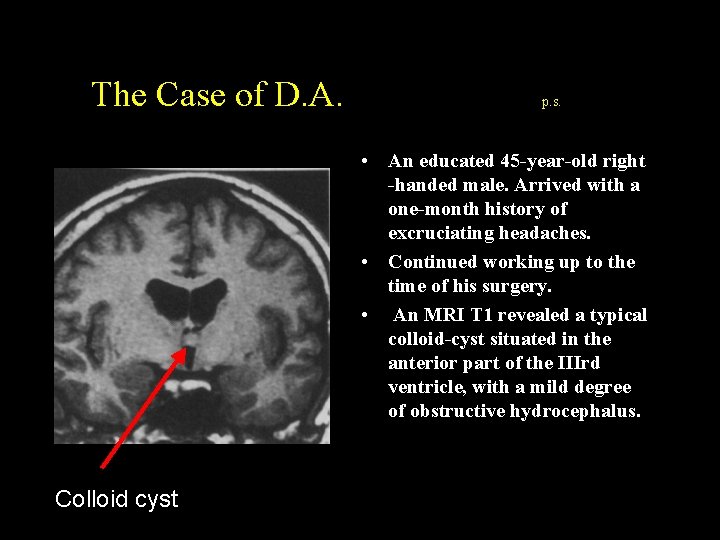 The Case of D. A. p. s. • An educated 45 -year-old right -handed The Case of D. A. p. s. • An educated 45 -year-old right -handed