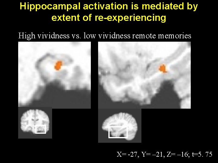 Hippocampal activation is mediated by extent of re-experiencing High vividness vs. low vividness remote Hippocampal activation is mediated by extent of re-experiencing High vividness vs. low vividness remote
