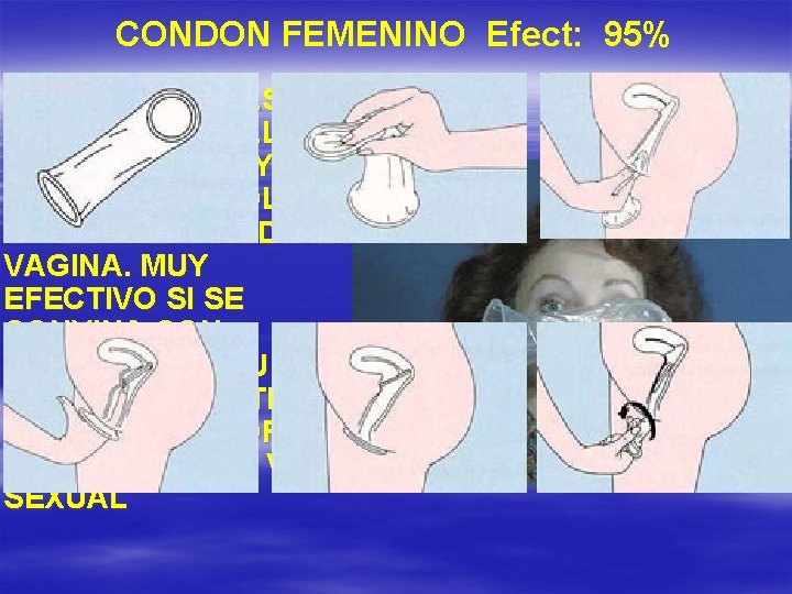 CONDON FEMENINO Efect: 95% ESPECIE DE BOLSA DE LATEX CON ANILLO EN CADA EXTREMOY