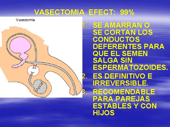 VASECTOMIA EFECT: 99% 1. SE AMARRAN O SE CORTAN LOS CONDUCTOS DEFERENTES PARA QUE
