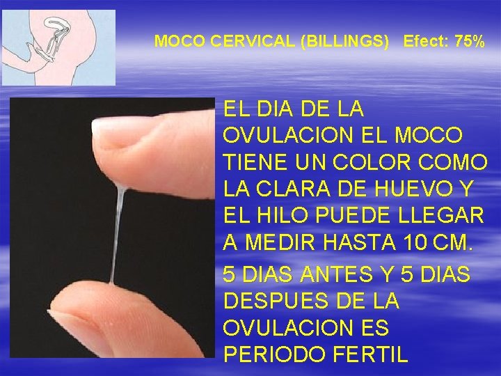 MOCO CERVICAL (BILLINGS) Efect: 75% EL DIA DE LA OVULACION EL MOCO TIENE UN