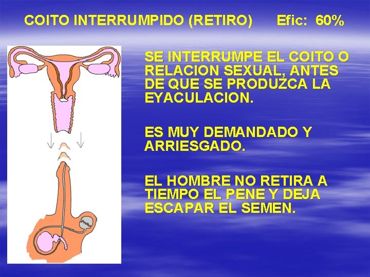COITO INTERRUMPIDO (RETIRO) Efic: 60% SE INTERRUMPE EL COITO O RELACION SEXUAL, ANTES DE