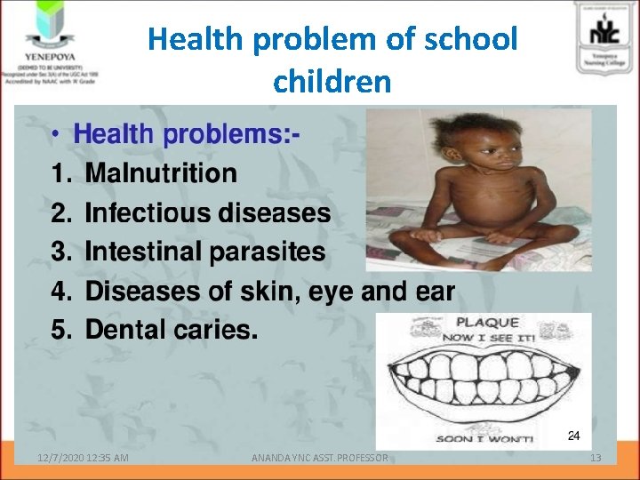 Health problem of school children 12/7/2020 12: 35 AM ANANDA YNC ASST. PROFESSOR 13