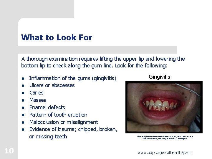 What to Look For A thorough examination requires lifting the upper lip and lowering
