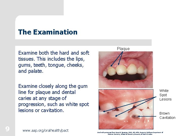 The Examination Examine both the hard and soft tissues. This includes the lips, gums,