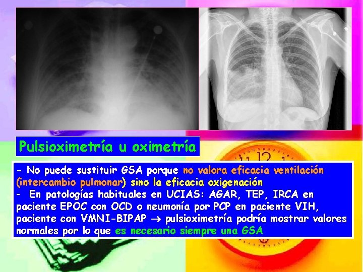 Pulsioximetría u oximetría - No puede sustituir GSA porque no valora eficacia ventilación (intercambio