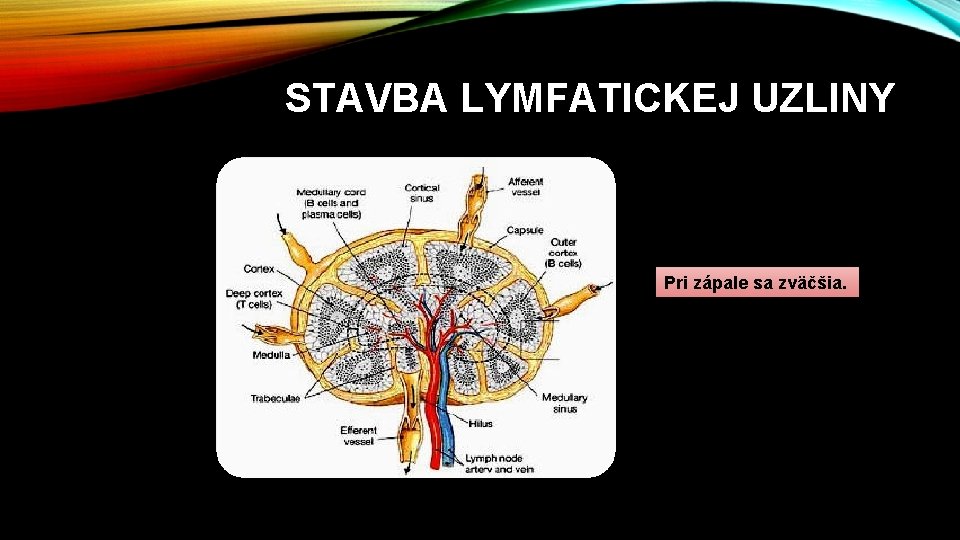 STAVBA LYMFATICKEJ UZLINY Pri zápale sa zväčšia. 