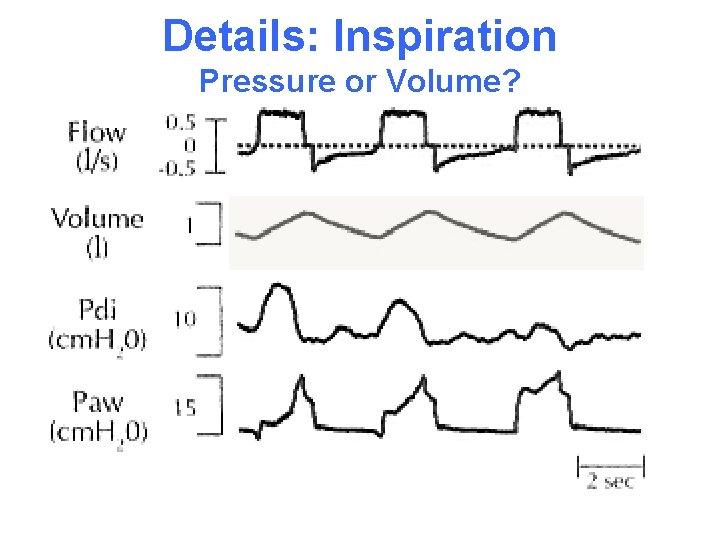 Details: Inspiration Pressure or Volume? 