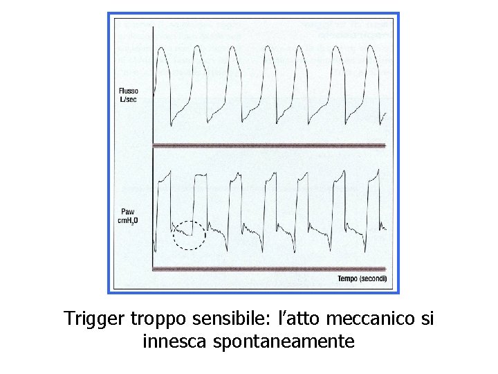 Trigger troppo sensibile: l’atto meccanico si innesca spontaneamente 
