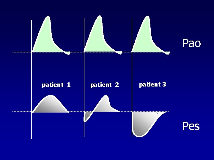 Pao patient 1 patient 2 patient 3 Pes 