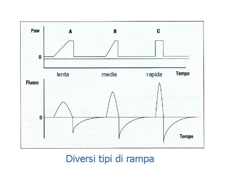 lenta media rapida Diversi tipi di rampa 
