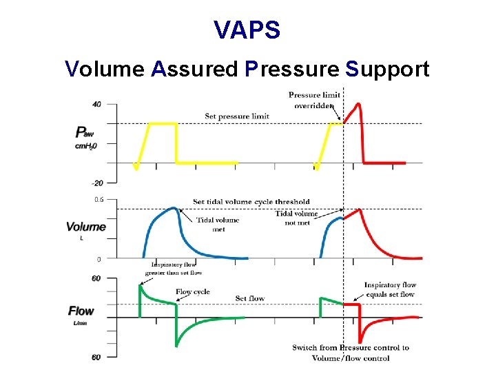 VAPS Volume Assured Pressure Support 
