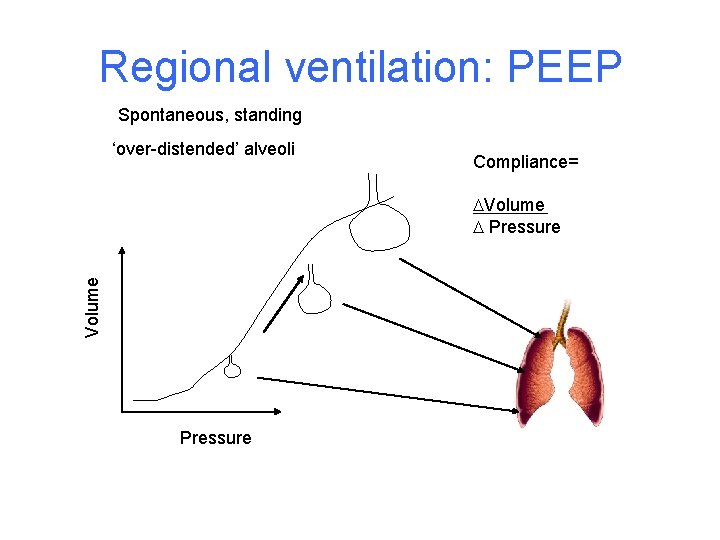 Regional ventilation: PEEP Spontaneous, standing ‘over-distended’ alveoli Compliance= Volume Pressure 