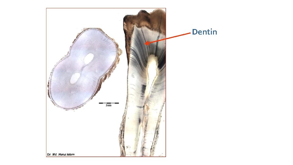 Dentin Pulp 