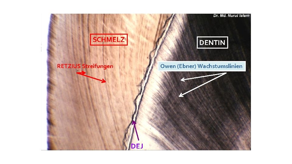 SCHMELZ DENTIN RETZIUS Streifungen Owen (Ebner) Wachstumslinien DEJ 