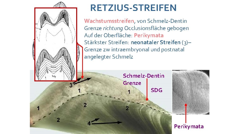 RETZIUS-STREIFEN Wachstumsstreifen, von Schmelz-Dentin Grenze richtung Occlusionsfläche gebogen Auf der Oberfläche: Perikymata Stärkster Streifen: