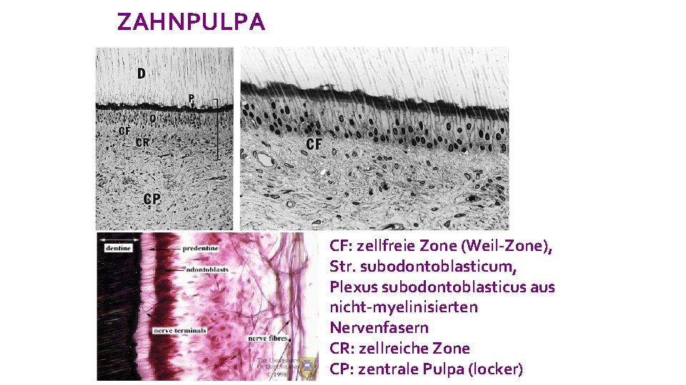 ZAHNPULPA CF: zellfreie Zone (Weil-Zone), Str. subodontoblasticum, Plexus subodontoblasticus aus nicht-myelinisierten Nervenfasern CR: zellreiche