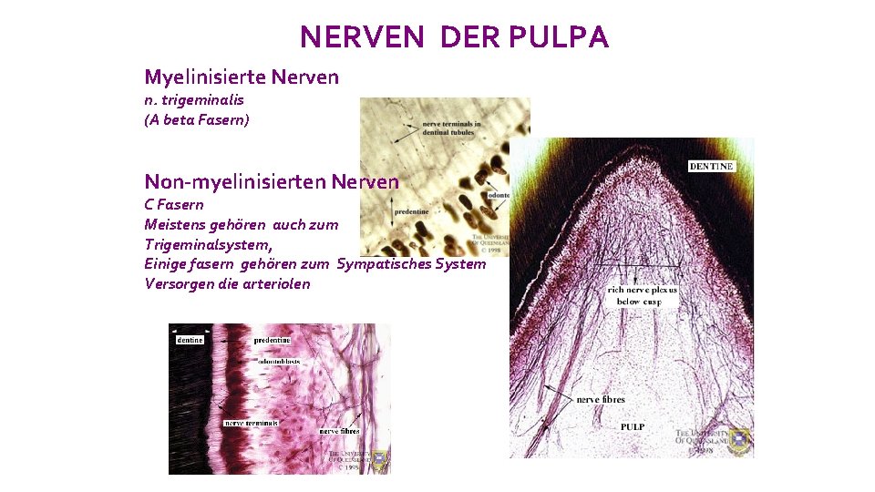 NERVEN DER PULPA Myelinisierte Nerven n. trigeminalis (A beta Fasern) Non-myelinisierten Nerven C Fasern