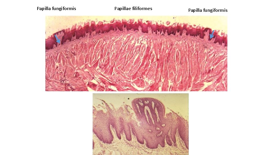 Papilla fungiformis Papillae filiformes Papilla fungiformis 