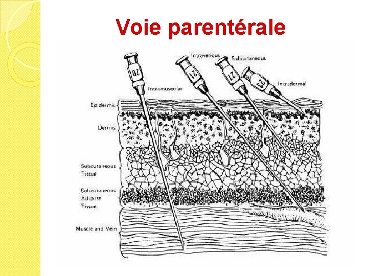 Voie parentérale 
