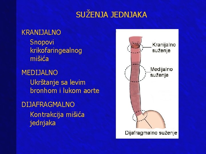 SUŽENJA JEDNJAKA KRANIJALNO Snopovi krikofaringealnog mišića MEDIJALNO Ukrštanje sa levim bronhom i lukom aorte SUŽENJA JEDNJAKA KRANIJALNO Snopovi krikofaringealnog mišića MEDIJALNO Ukrštanje sa levim bronhom i lukom aorte